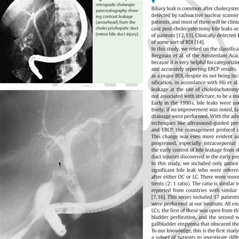 Endoscopic Retrograde Cholangiopancreatography Showing Contrast Leakage