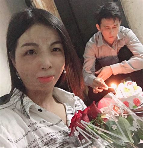 Mối Tình đẹp Của Anh Shipper điển Trai Và Cô Gái Mặt đầy Sẹo Vì Bỏng