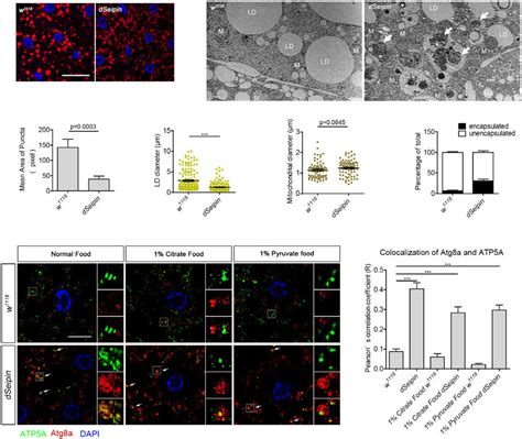 Mitochondrial Defects In Dseipin Mutant Fat Cells A Mitochondria In