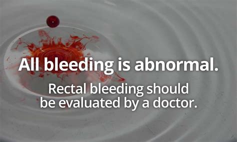 Understanding Rectal Bleeding Plano Tx Matthew Eidem Md