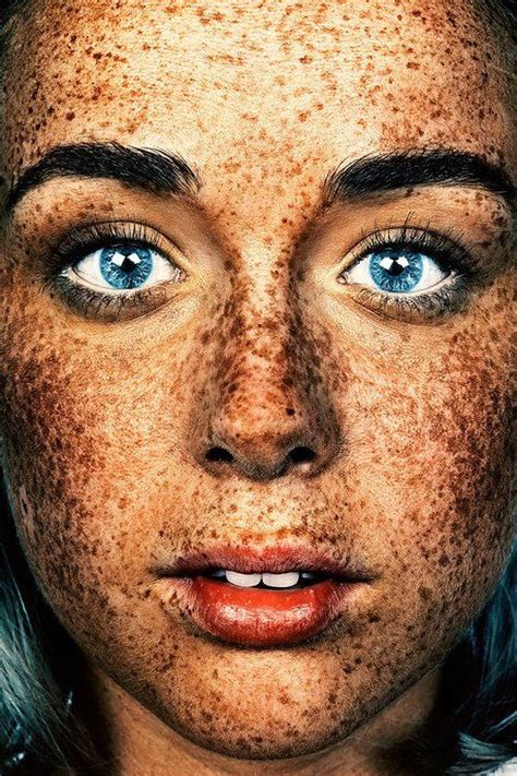 These Photos Of Freckles Will Make You Love Your Spots Even More People
