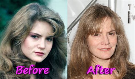 Jennifer leigh has openly admitted that she has undergone cosmetic surgery. What You Need to Know About Jennifer Jason Leigh Plastic ...