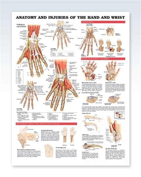 Injuries Of The Hand And Wrist Exam Room Anatomy Poster Clinicalposters