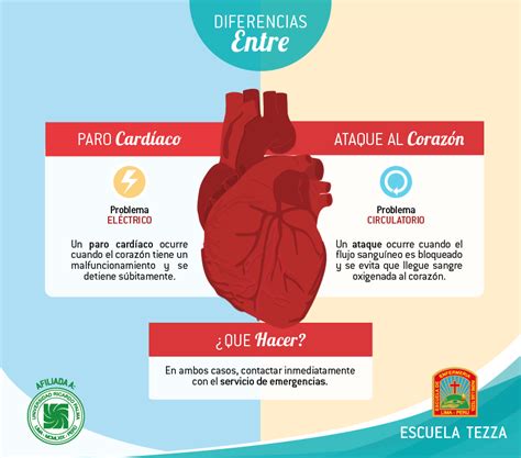Blog De La Escuela Tezza Diferencias Entre Paro Cardíaco Y Ataque Al