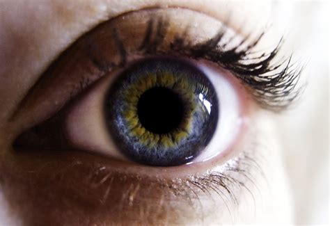 Central Heterochromia Two Colours In One Iris Rmildlyinteresting