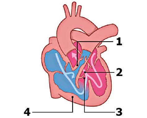 Schematic Overview Of The Defects Seen In Tetralogy Of Fallot 1