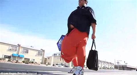 21board Media Man With 100 Pound Scrotum Rejects Offers To Perform 1 Million Corrective