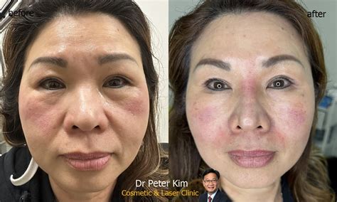 Dr Peter Kim Surgery Skin Cancer Cosmetic And Laser Clinic