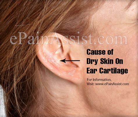 Skin Cancer On Ear Cartilage