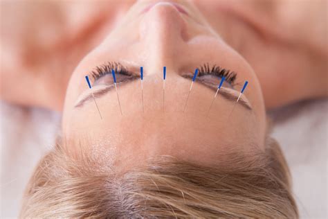 Skin Care Benefits Of Acupuncture Popsugar Beauty
