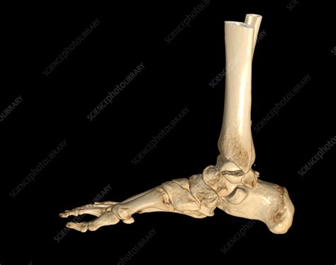 Foot And Ankle 3d Ct Scan Stock Image F0369774 Science Photo