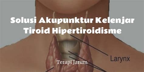 Solusi Akupunktur Kelenjar Tiroid Hipertiroidisme Terapi Jarum