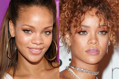 Has Rihanna Had Cosmetic Surgery