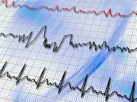 Rapid Or Irregular Heartbeat 10 Symptoms Of Low Blood Pressure