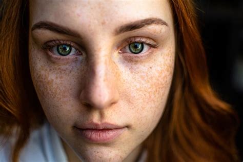 Free Face Image On Unsplash Skin Health Itching Skin Face Pictures