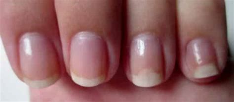 Vous Avez Des T Ches Blanches Sur Les Ongles C Est Incroyable Ce N Est Pas Du Tout Ce Que