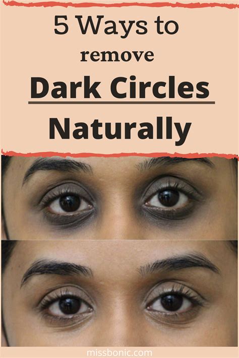 5 Ways To Remove Dark Circles Naturally Remove Dark Circles Dark