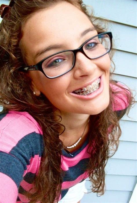 79 Ideas How To Look Good With Braces And Glasses With Simple Style