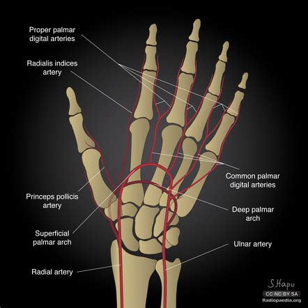 Palmar Carpal Branches Radiology Reference Article Radiopaedia Org