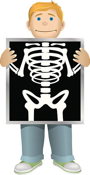 X Ray Clipart Free 10 Free Cliparts Download Images On Clipground 2024