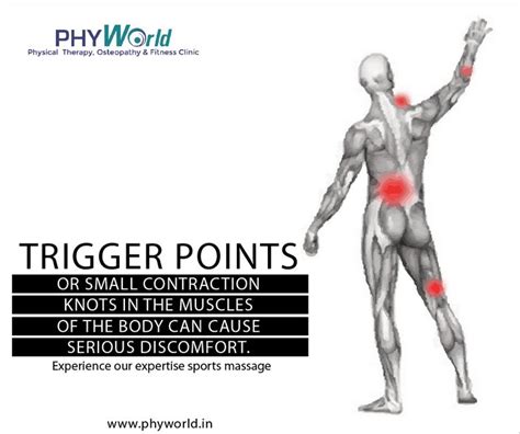 Trigger Points Or Small Contraction Knots In The Muscles Of The Body