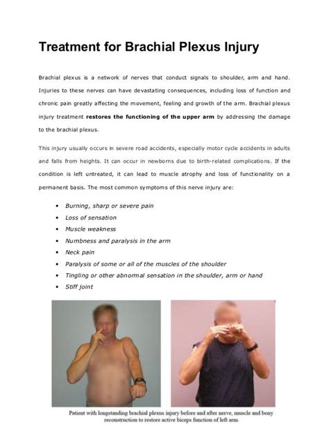 Treatment For Brachial Plexus Injury