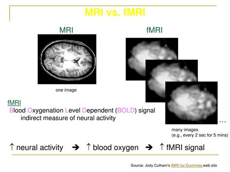 Ppt Fmri Functional Magnetic Resonance Imaging And Optic Neuritis