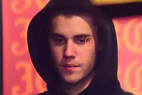Justin Bieber Gets A Face Tattoo Check Out His Latest Ink