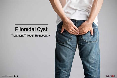 Pilonidal Cyst Treatment Through Homeopathy By Dr Jay Verma Lybrate