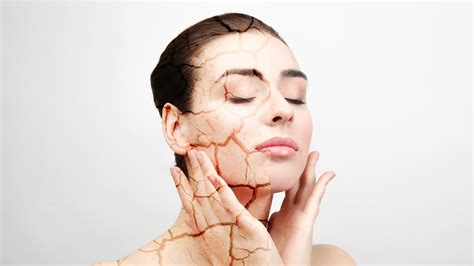 What Dry Skin May Mean For Your Health Affiliated