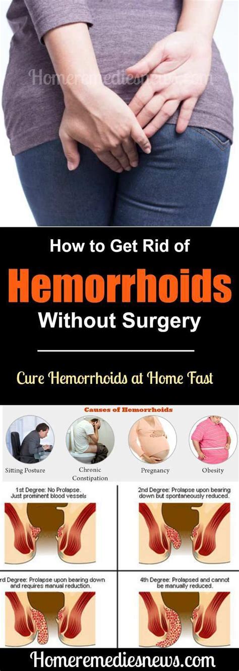 How To Get Rid Of Hemorrhoids Without Surgery Home Remedies For