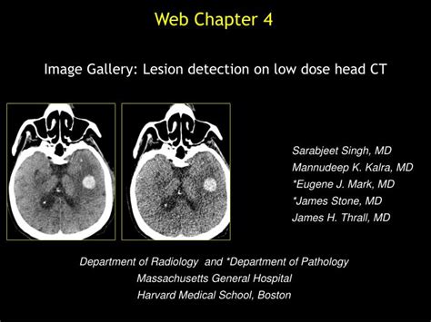 Ppt Image Gallery Lesion Detection On Low Dose Head Ct Powerpoint