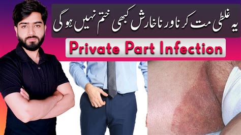 Jock Itch Treatment Tinea Cruris Private Part Itch Babar Ali