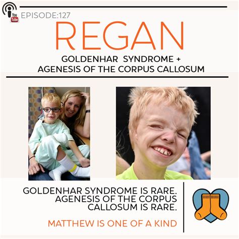 Goldenhar Syndrome Archives Orangesocks Org