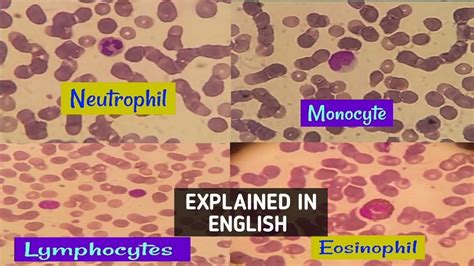 Neutrophillymphocytemonocyte And Eosinophil Actual View Under