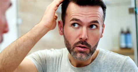 There are many underlying reasons and they could be medical as well as those related with the state of your body. How much hair loss is normal? Brushing, washing, and more