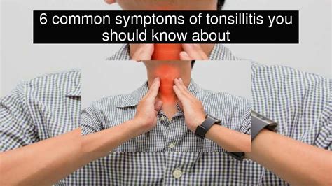 6 Common Symptoms Of Tonsillitis You Should Know About Youtube