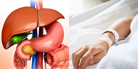 Gallbladder Removal Heres What To Expect Before During And After Self