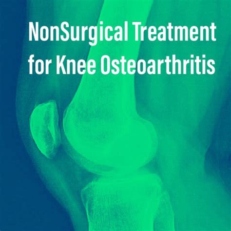 Non Surgical Treatment Options For Knee Osteoarthritis Chicago