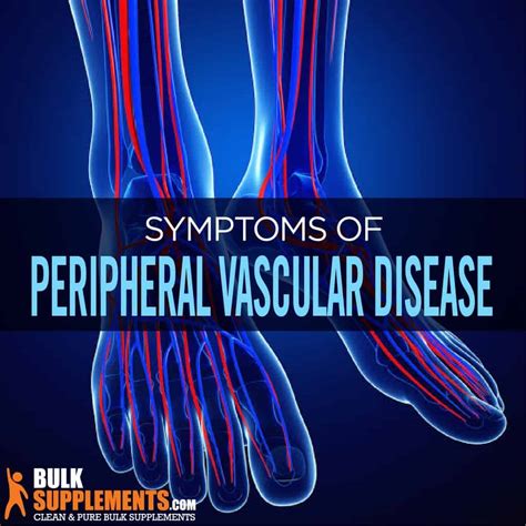 What Are The Symptoms Of Peripheral Vascular Disease In The Feet