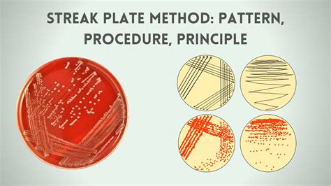 Streak Plate Method Patterns Procedure Principle