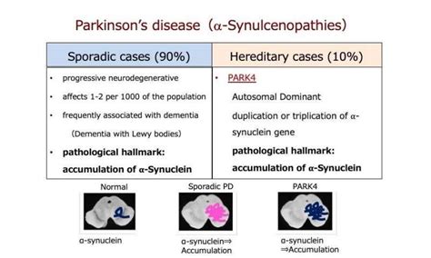Pathophysiology continues to be an area for research, as scientists work to understand how and why pd develops and continue to search for ways to stop the progression of the. Stopping Parkinson's disease before it starts ...