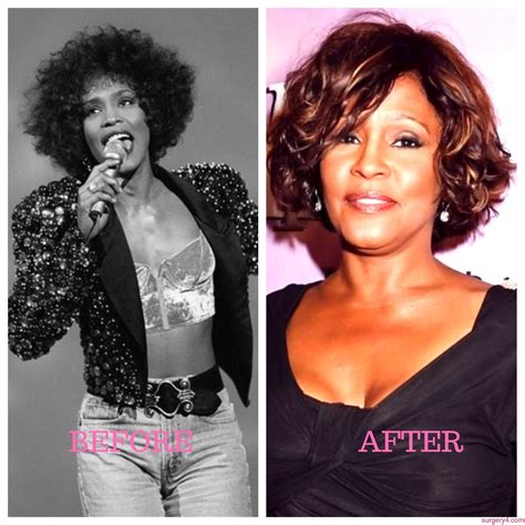 Whitney Houston Plastic Surgery Photos Before And After ⋆ Surgery4