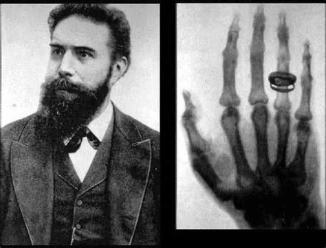 How Wilhelm Roentgen Started The X Ray Craze Kathy Loves Physics
