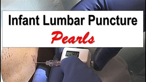 Infant Lumbar Puncture Pearls Youtube