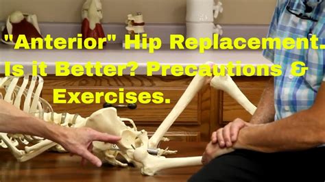 Exercises After Anterior Hip Replacement Surgery Exercise Poster