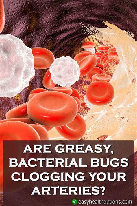 Easy Health Options Are Greasy Bacterial Bugs Clogging Your