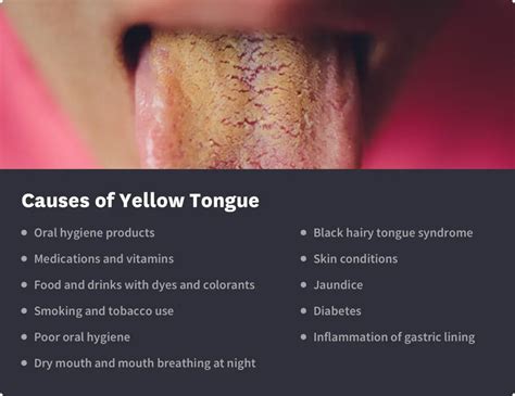 Why Is My Tongue Yellow And Do I Need To See A Doctor Byte® Byte®