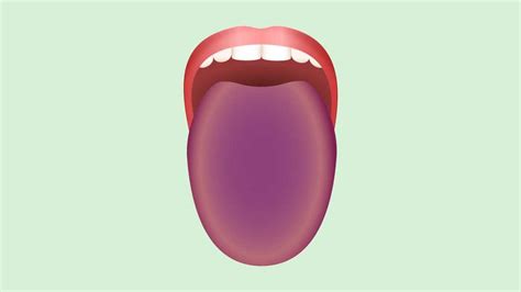 What Does A Healthy Tongue Look Like All Things Health