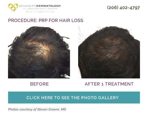 When it doesn't, a dermatologist may include one or more of these options in your treatment plan. Dermatologist Specialist In Hair Loss